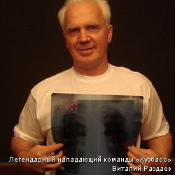 Снимки лёгких знаменитостей вывешены в музее Кемерова
