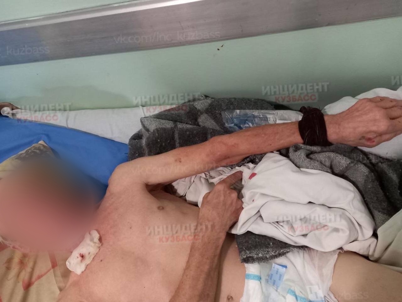 Привязан к кровати, на лице кровь: в больнице Новокузнецка объяснили шокирующие фото пациента