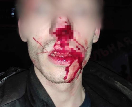 Каннибализм в Кузбассе: полиция прокомментировала инцидент с откушенными частями тела